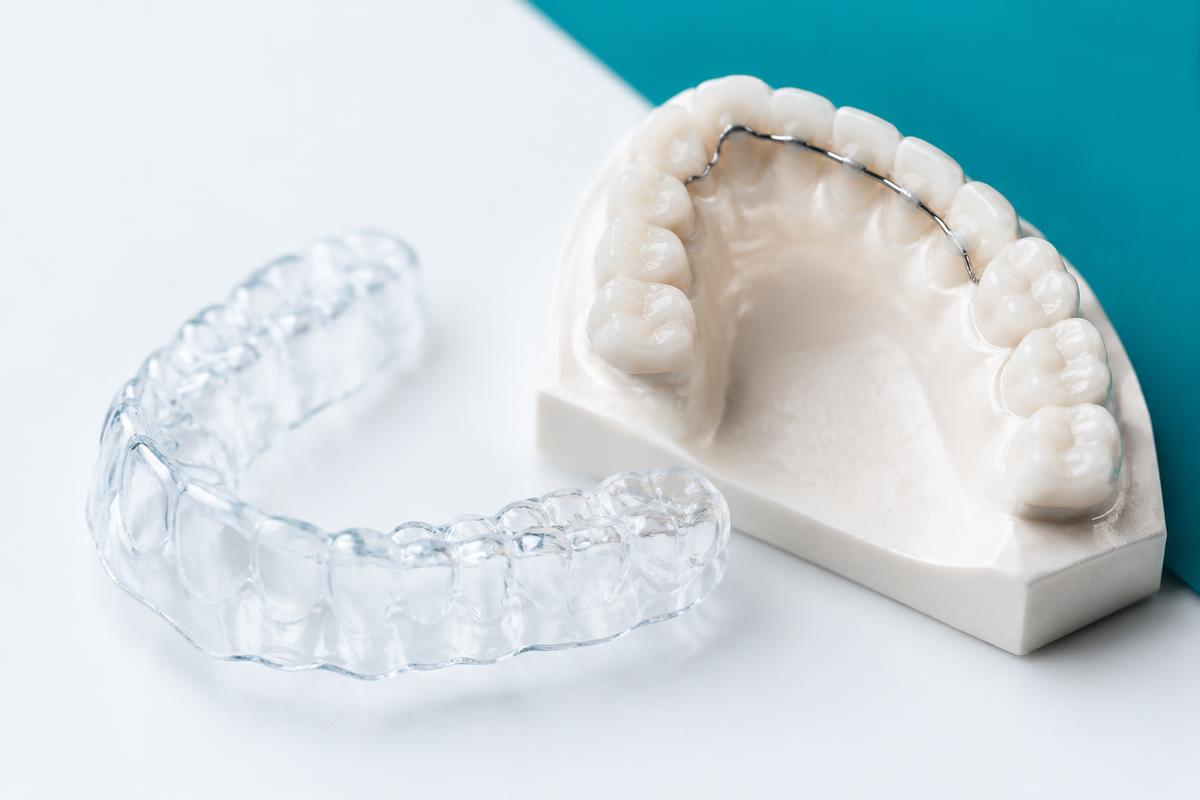 Retainer dopo l’apparecchio: perché la contenzione è essenziale — trattamenti dentali di ortodonzia nello studio dentistico DentalNet Care