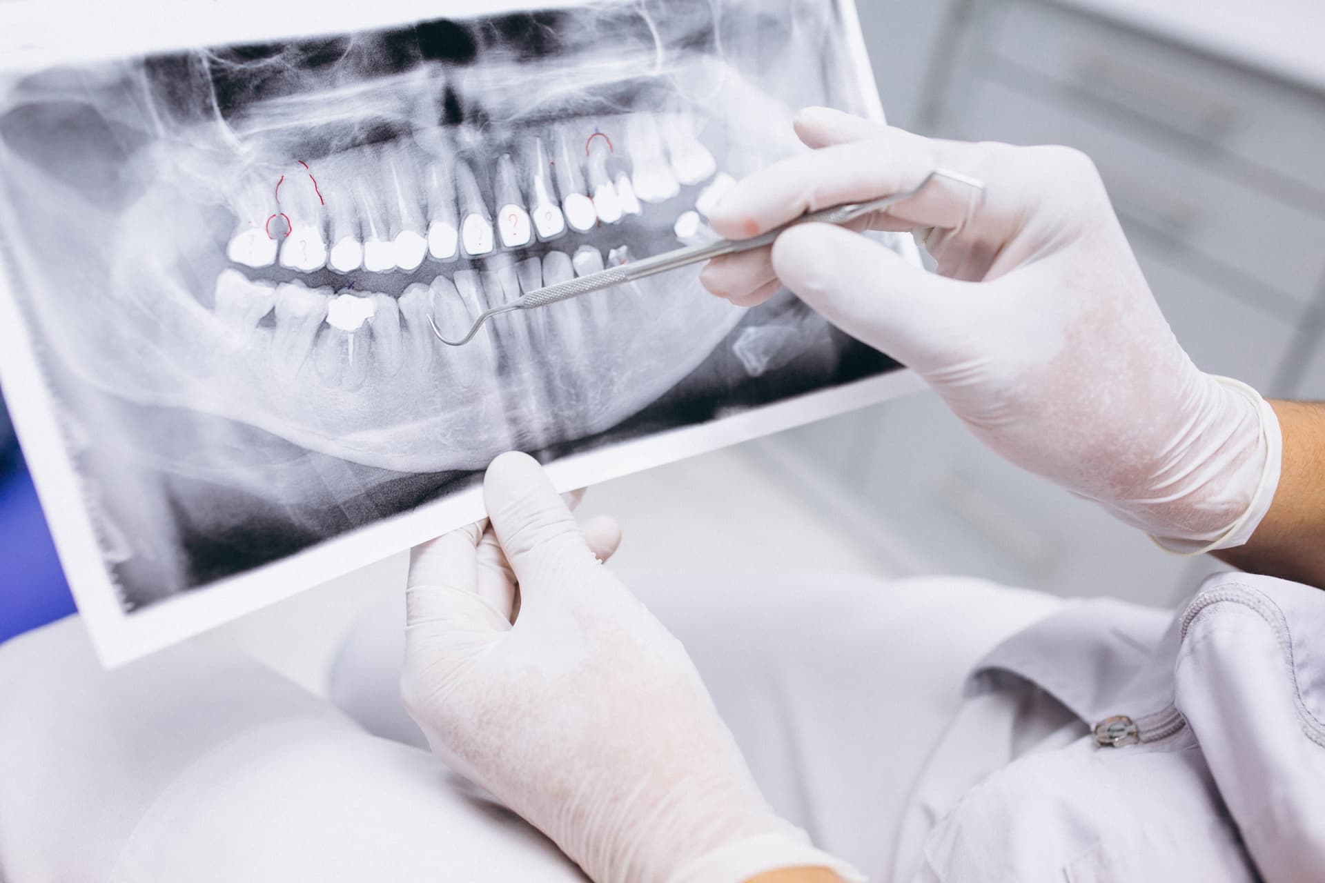 Implantologia dentale: dettaglio clinico in uno studio partner DentalNet Care