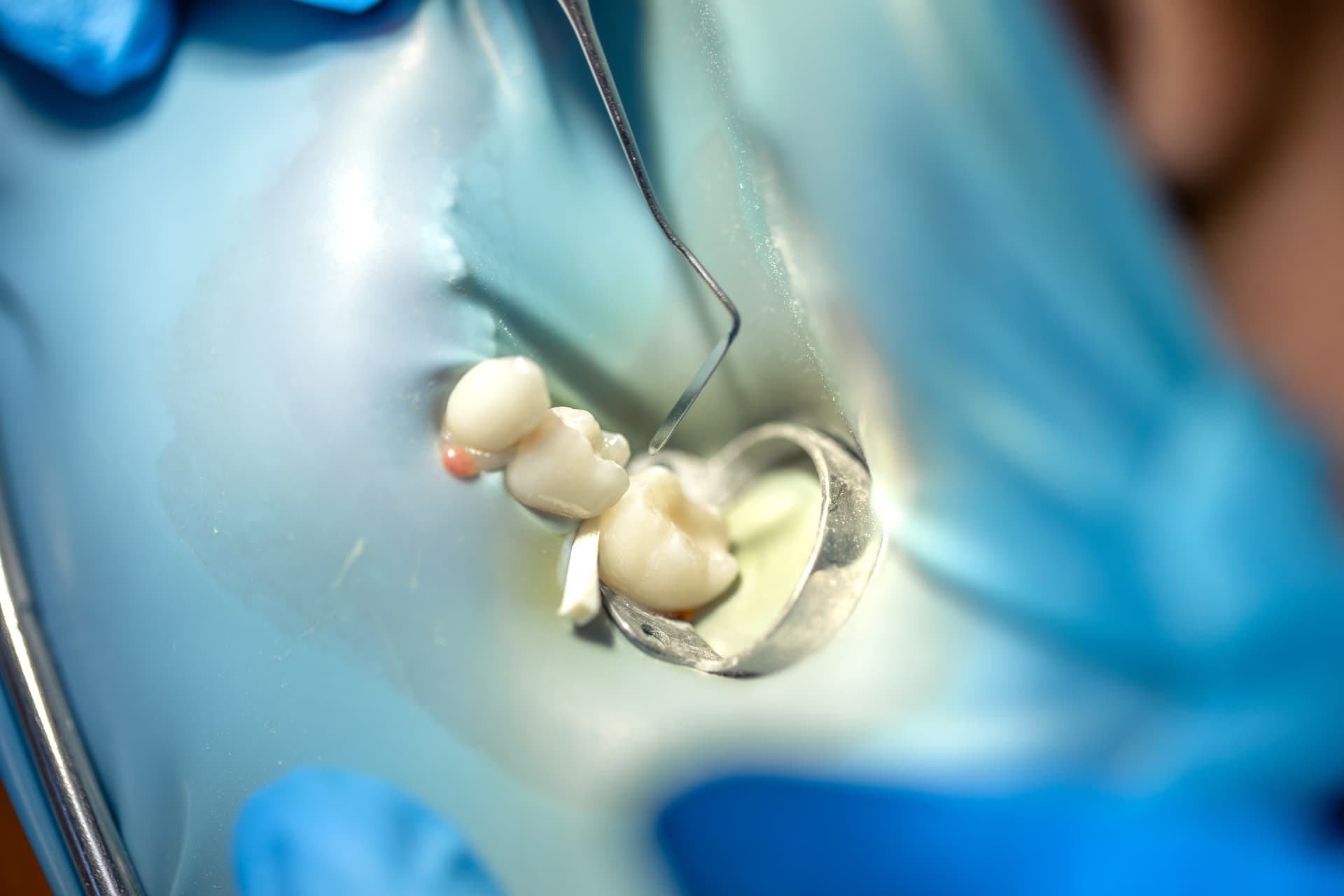 Conservativa ed endodonzia: dettaglio clinico in uno studio partner DentalNet Care