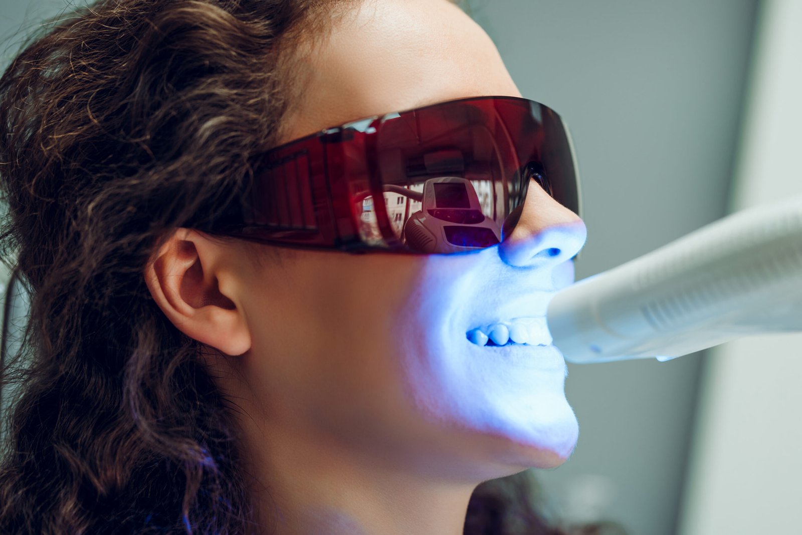 quanto dura sbiancamento dentale