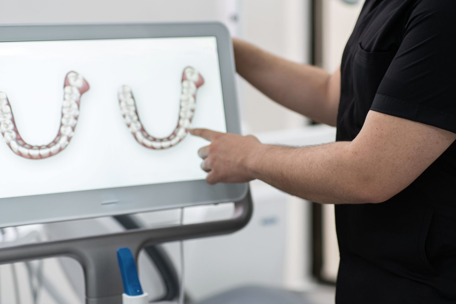 Macchie bianche sui denti: Cosa sono e perchè appaiono