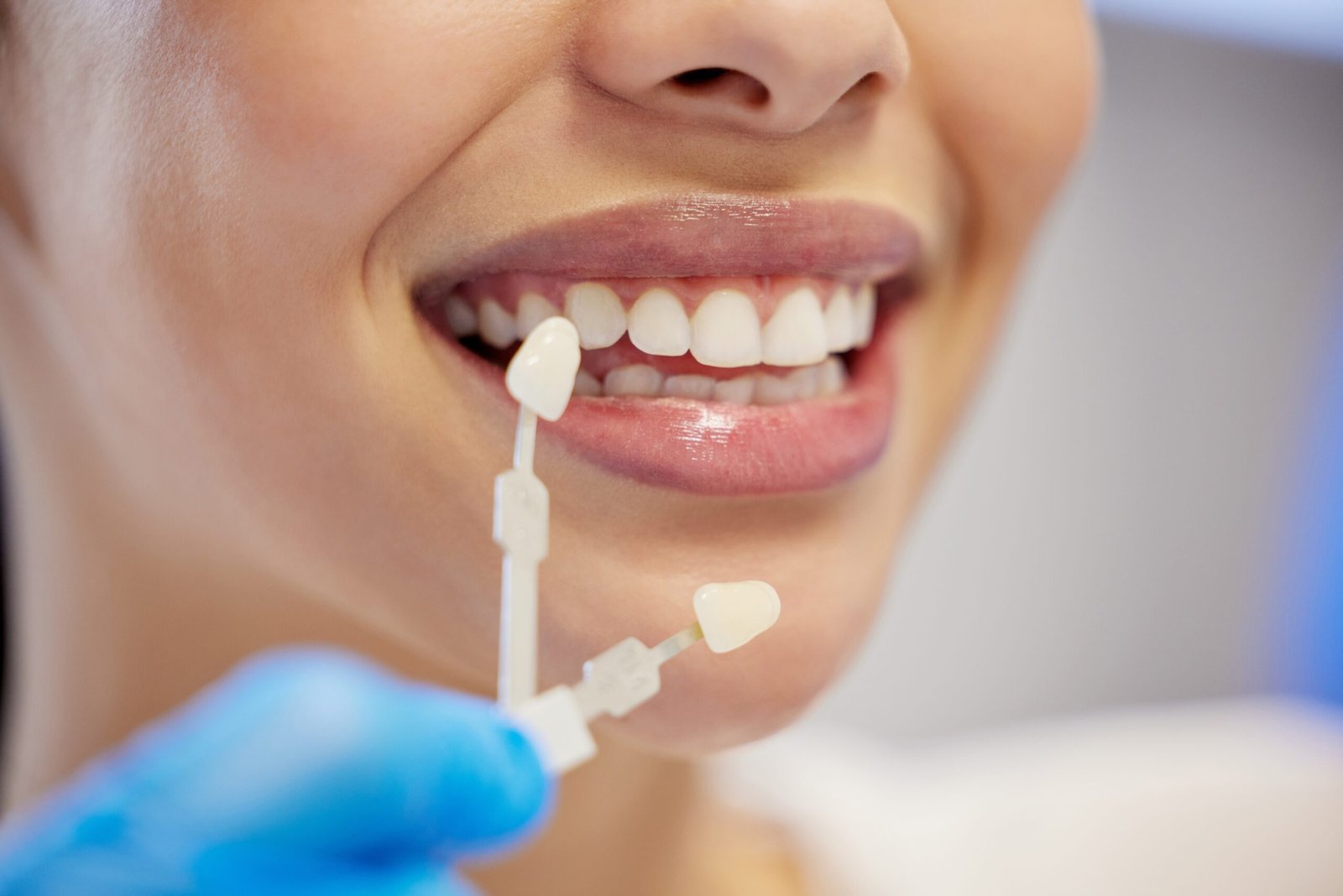 Denti gialli: quali sono le cause e perché accade