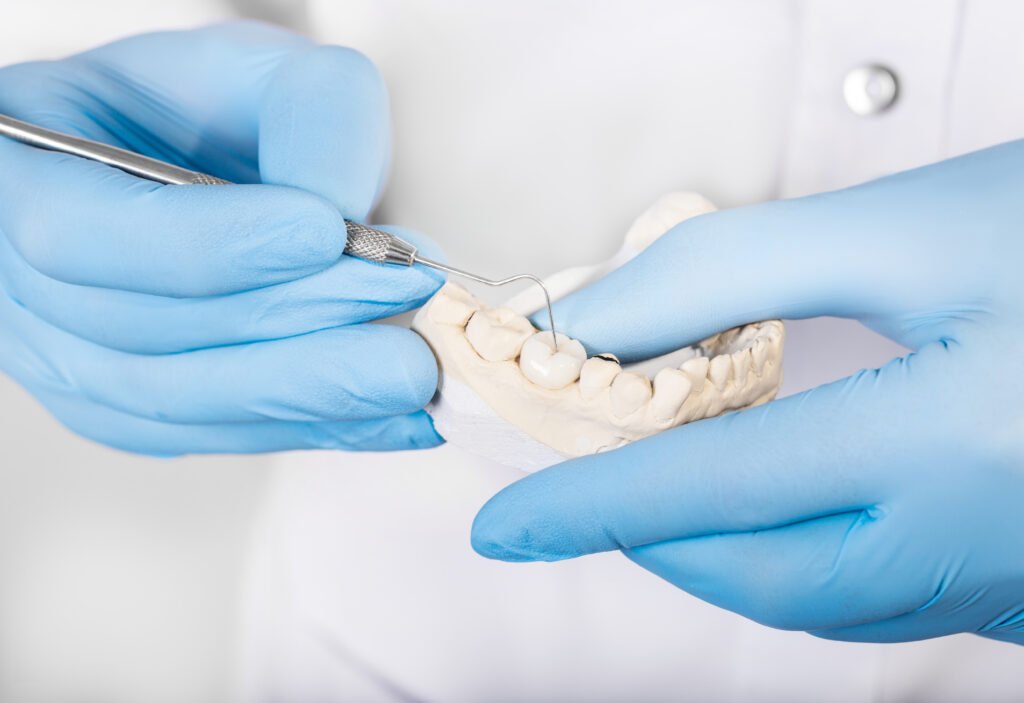 Vassoi In Ceramica Bianca: La Bellezza Allo Stato Puro - Foto 12